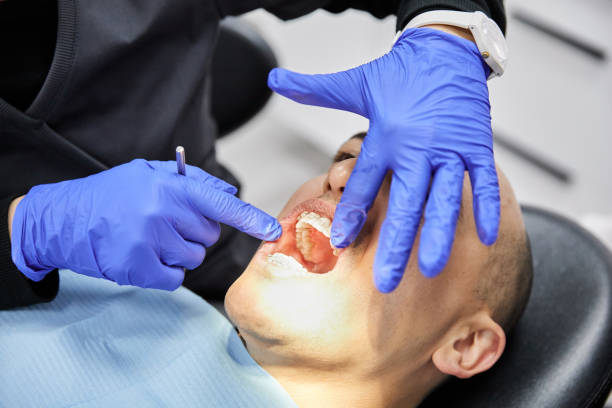 Best Knocked-Out Tooth (Avulsed Tooth) Treatment in Clinton, TN